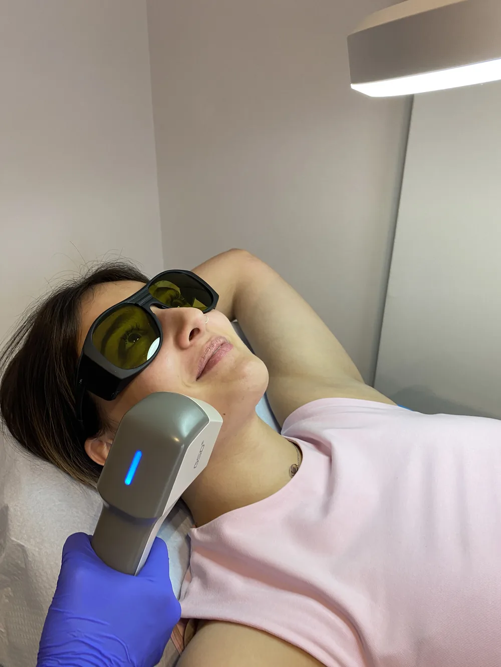 Laser αποτρίχωση για γυναίκες στο Medithea στη Δάφνη